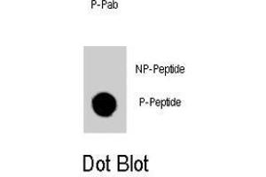 Dot blot analysis of GATA6 (phospho Y271) polyclonal antibody  on nitrocellulose membrane. (GATA6 anticorps  (pTyr271))