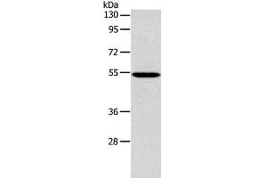 Western Blot analysis of 293T cell using ERG Polyclonal Antibody at dilution of 1:650 (ERG anticorps)