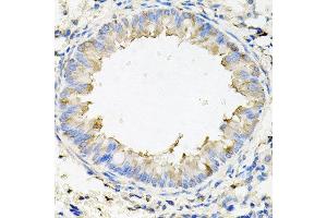 Immunohistochemistry of paraffin-embedded mouse lung using CALU antibody at dilution of 1:100 (x40 lens). (CALU anticorps)