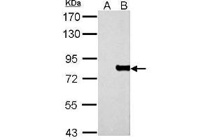 WB Image MX1 antibody detects MX1 protein by Western blot analysis. (MX1 anticorps  (Center))