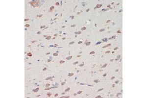 Immunohistochemistry of paraffin-embedded rat brain using SERPINI1 antibody (ABIN7270251) at dilution of 1:200 (40x lens).