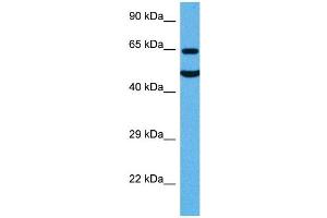 Host:  Rat  Target Name:  SLC1A2  Sample Tissue:  Rat Brain  Antibody Dilution:  1ug/ml