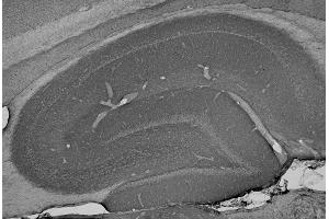 Adult rat hippocampus immunohistochemistry. (ANK2 anticorps  (AA 203-496))