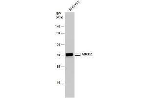 WB Image ABCD2 antibody detects ABCD2 protein by western blot analysis. (Abcd2 anticorps)