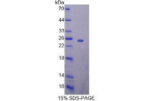 SDS-PAGE analysis of Mouse BAG5 Protein. (BAG5 Protéine)