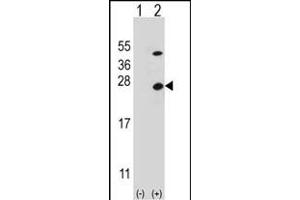 Western blot analysis of ATP5O (arrow) using rabbit polyclonal ATP5O Antibody (N-term) (ABIN652503 and ABIN2842338).