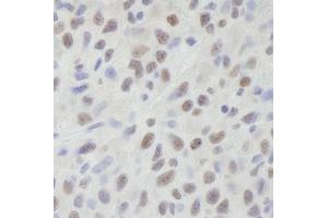 Immunohistochemistry (IHC) image for anti-ATP-Dependent RNA Helicase A (DHX9) (C-Term) antibody (ABIN7448530)