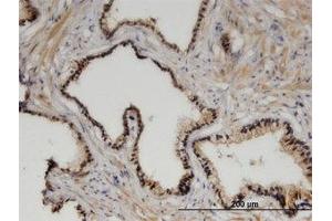 Image no. 1 for anti-Zinc Fingers and Homeoboxes 3 (ZHX3) (AA 863-955) antibody (ABIN599532) (ZHX3 anticorps  (AA 863-955))