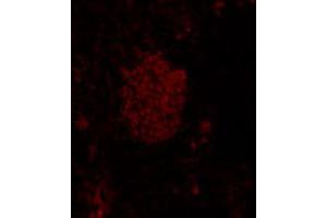 Immunofluorescence analysis of mouse pancreas tissue, using Mnx1 polyclonal antibody  . (MNX1 anticorps)