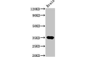 Western Blot Positive WB detected in: Rat brain tissue All lanes: NKX3-2 antibody at 4. (NKX3-2 anticorps  (AA 1-333))