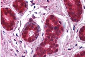 Human Breast (formalin-fixed, paraffin-embedded) stained with NFKBIA antibody ABIN218609 at 1:1000 followed by biotinylated goat anti-rabbit IgG secondary antibody ABIN481713, alkaline phosphatase-streptavidin and chromogen. (NFKBIA anticorps  (C-Term))