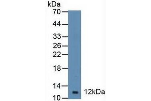 Diazepam Binding Inhibitor 抗体  (AA 1-104)