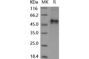 Western Blotting (WB) image for Follistatin (FST) (Active) protein (His tag) (ABIN7320423)