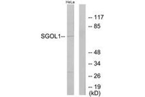 Western Blotting (WB) image for anti-Shugoshin 1 (SGOL1) (AA 271-320) antibody (ABIN2889634) (Shugoshin anticorps  (AA 271-320))