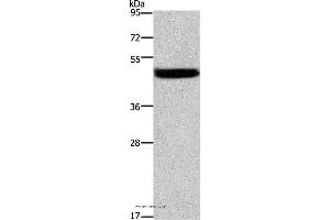 Western blot analysis of Mouse stomach tissue, using CTSE Polyclonal Antibody at dilution of 1:525 (Cathepsin E anticorps)
