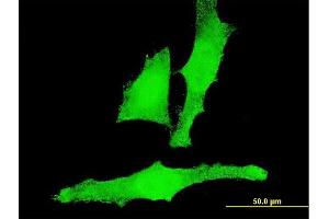 Immunofluorescence of monoclonal antibody to ACAN on HeLa cell.