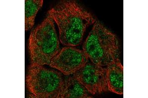 Immunofluorescent staining of A-431 cells using DUSP10 polyclonal antibody  shows positivity in nucleus (green) but excluded from the nucleoli. (DUSP10 anticorps  (AA 180-291))
