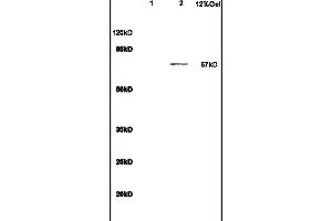 Lane 1: mouse heart lysates Lane 2: S/P20 Cell lysates probed with Anti IL-23R Polyclonal Antibody, Unconjugated (ABIN686857) at 1:200 in 4 °C.