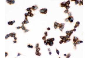 IHC analysis of TCP1 delta using anti-TCP1 delta antibody .