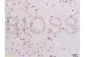 Formalin-fixed and rat brain tissue labeled with Anti-Midnolin Polyclonal Antibody, Unconjugated  1:200 followed by conjugation to the secondary antibody and DAB staining (MIDN anticorps  (AA 51-150))
