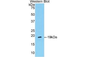 Detection of Recombinant ANGPT1, Rat using Polyclonal Antibody to Angiopoietin 1 (ANGPT1)