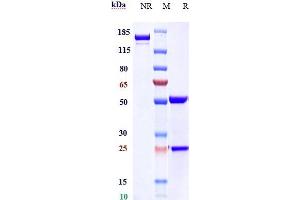 Anti- Human CLDN6( IMAB027) on SDS-PAGE under reducing (R) condition. (Recombinant Claudin 6 anticorps)