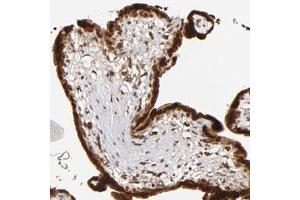Immunohistochemical staining of human placenta with IGF2BP3 polyclonal antibody  shows strong cytoplasmic and nuclear positivity in trophoblastic cell at 1:50-1:200 dilution. (IGF2BP3 anticorps)