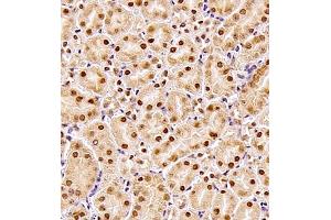 Immunohistochemistry of paraffin embedded mouse kidney using ZHX3 (ABIN7076287) at dilution of 1:700 (400x lens)