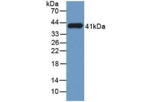 Detection of Recombinant TPS, Human using Monoclonal Antibody to Tryptase (TPS)