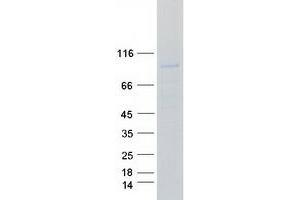 Validation with Western Blot