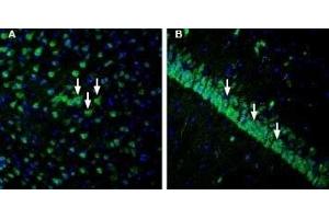 Expression of IGF1R in rat cortex and hippocampus - Immunohistochemical staining of perfusion-fixed frozen rat brain sections with Anti-IGF1R (extracellular) Antibody (ABIN7043290, ABIN7044798 and ABIN7044799), (1:1200), followed by goat anti-rabbit-AlexaFluor-488.