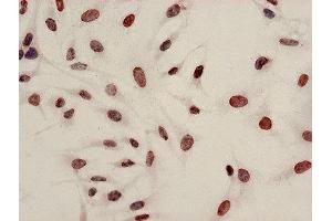 Immunocytochemistry analysis of Hela cells using ABIN7139199 at dilution of 1:100
