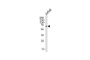 Western blot analysis of lysate from Jurkat cell line, using IL2RG Antibody (N-term) (ABIN653403 and ABIN2842858). (IL2RG anticorps  (N-Term))