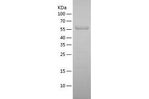 Western Blotting (WB) image for Carboxylesterase 1C (CES1C) (AA 19-550) protein (His tag) (ABIN7122137)