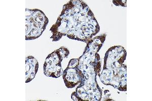 Immunohistochemistry of paraffin-embedded human placenta using PEG10 Rabbit pAb (ABIN3016692, ABIN3016693, ABIN1681320 and ABIN6219814) at dilution of 1:100 (40x lens).