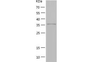 Western Blotting (WB) image for Guanosine Monophosphate Reductase (GMPR) (AA 1-345) protein (His-IF2DI Tag) (ABIN7123243)