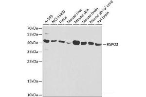 Western blot analysis of extracts of various cell lines using RSPO3 Polyclonal Antibody at dilution of 1:1000.