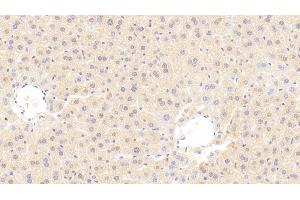 Detection of MMP3 in Mouse Liver Tissue using Polyclonal Antibody to Matrix Metalloproteinase 3 (MMP3)