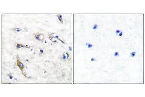Immunohistochemistry (IHC) image for anti-PRA1 Domain Family, Member 2 (PRAF2) (C-Term) antibody (ABIN1848624) (PRAF2 anticorps  (C-Term))