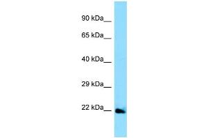 WB Suggested Anti-EFNA5 Antibody Titration: 1. (Ephrin A5 anticorps  (Middle Region))