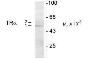 Western Blotting (WB) image for anti-Thyroid Hormone Receptor, alpha (THRA) (N-Term) antibody (ABIN371844) (THRA anticorps  (N-Term))