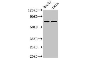 Western Blot Positive WB detected in: HepG2 whole cell lysate, Hela whole cell lysate All lanes: AMFR antibody at 4 μg/mL Secondary Goat polyclonal to rabbit IgG at 1/50000 dilution Predicted band size: 73 kDa Observed band size: 73 kDa