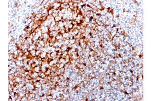 Formalin-fixed, paraffin-embedded human Tonsil stained with Cystatin A Mouse Monoclonal Antibody (CPTC-CSTA-1).