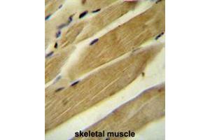 RPH3A Antibody (C-term) immunohistochemistry analysis in formalin fixed and paraffin embedded human skeletal muscle followed by peroxidase conjugation of the secondary antibody and DAB staining. (RPH3AL anticorps  (C-Term))