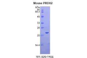 SDS-PAGE analysis of Mouse Peroxiredoxin 2 Protein. (Peroxiredoxin 2 Protein (PRDX2))