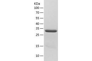 Western Blotting (WB) image for PDZ Binding Kinase (PBK) (AA 1-322) protein (His-IF2DI Tag) (ABIN7124331)