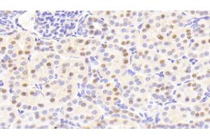 Detection of ANP32A in Human Kidney Tissue using Polyclonal Antibody to Acidic Nuclear Phosphoprotein 32 Family, Member A (ANP32A)