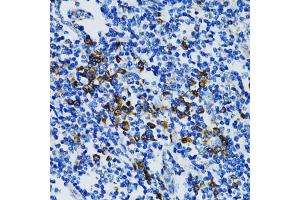 Immunohistochemistry of paraffin-embedded human tonsil using STAT3 antibody (ABIN5998978) at dilution of 1/100 (40x lens). (STAT3 anticorps)