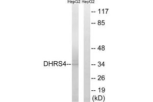 Western blot analysis of extracts from HepG2 cells, using DHRS4 antibody. (DHRS4 anticorps  (C-Term))