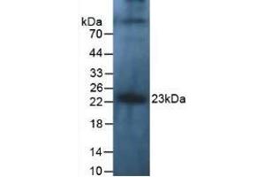 Detection of IL10 in Human Leukocyte Cells using Polyclonal Antibody to Interleukin 10 (IL10) (IL-10 anticorps  (AA 1-178))